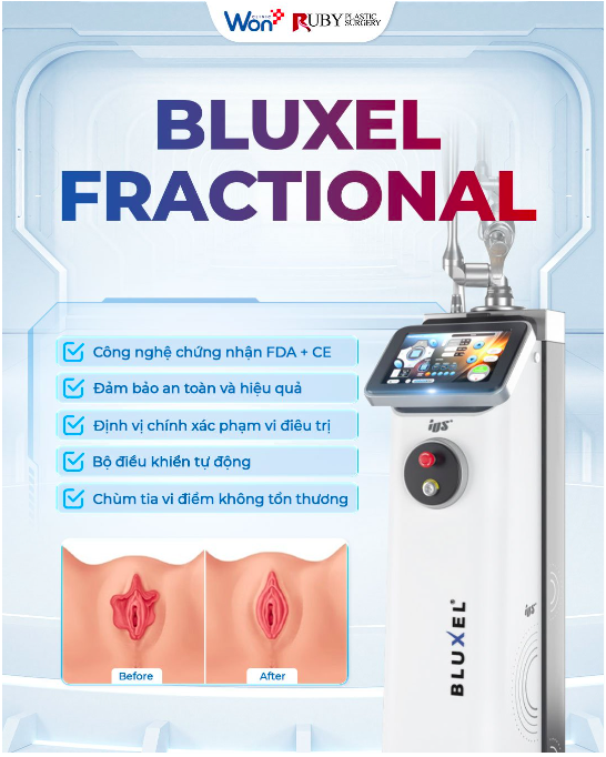 Bluexel Fractional X V-Secret - Công nghệ cao điều trị viêm nhiễm phụ khoa triệt để không xâm lấn
