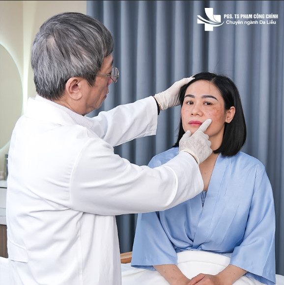 Điều trị tàn nhang: Chọn laser hay peel da?