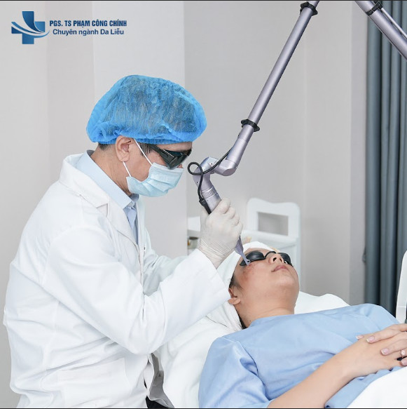 Điều trị tàn nhang: Chọn laser hay peel da?